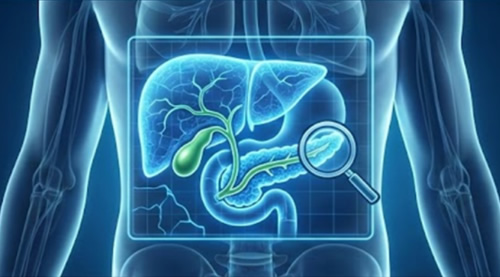 MRCP（MRI）イメージ